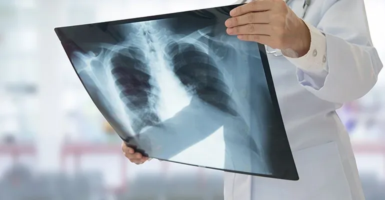أفضل مراكز الأشعة في الرياض
