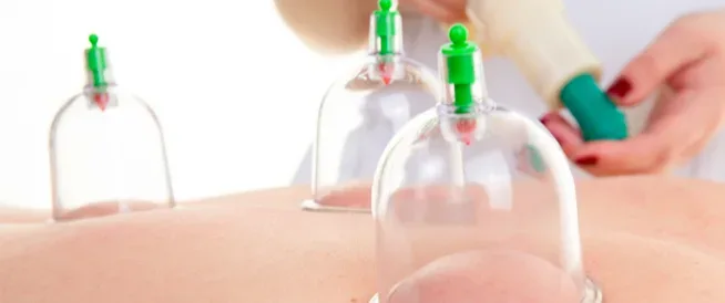 أفضل 4 من مراكز الحجامة في الرياض ننصحك بها